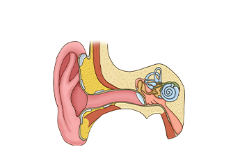 纯音测听传导性听力下降